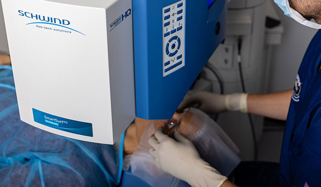 Image keratopigmentation clinique des yeux operation de