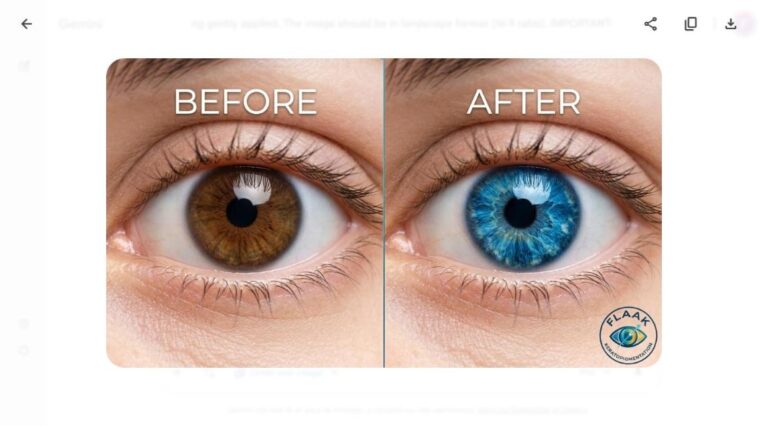 Keratopigmentation before and after results - brown eye transformed to blue eye at FLAAK Paris clinic